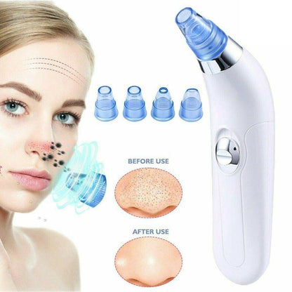 Magic Blackhead Remover Skin Care Pore Vacuum Tool