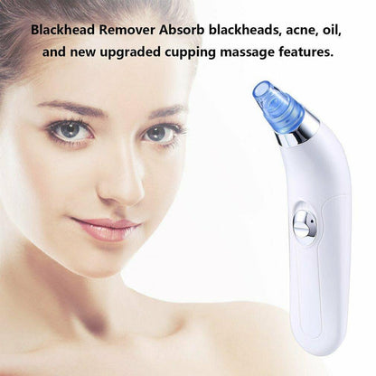 Magic Blackhead Remover Skin Care Pore Vacuum Tool