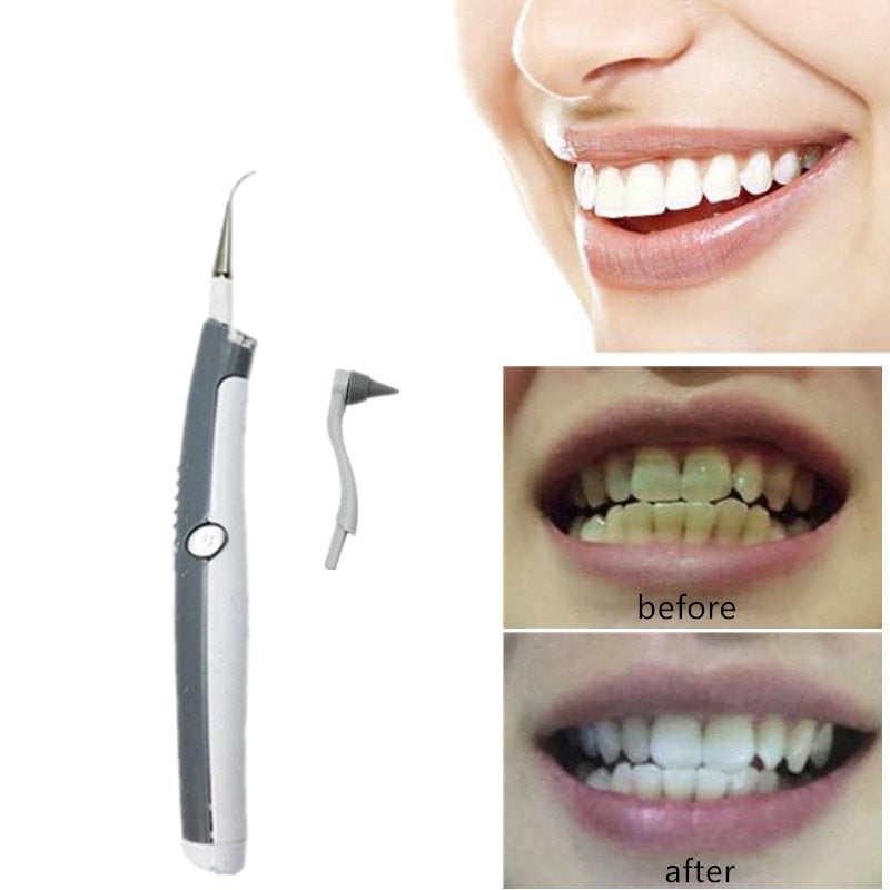 New Ultrasonic Dental Cleaning Tool