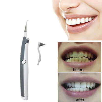 New Ultrasonic Dental Cleaning Tool