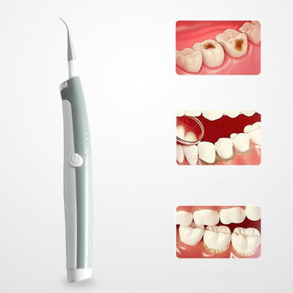 New Ultrasonic Dental Cleaning Tool